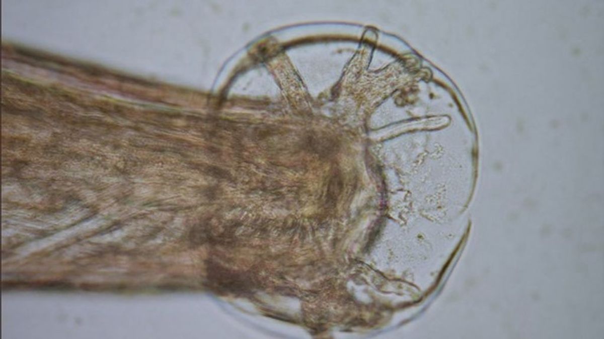 Investigadores mallorquines han detectado, por primera vez en Europa, un gusano que puede causar meningitis