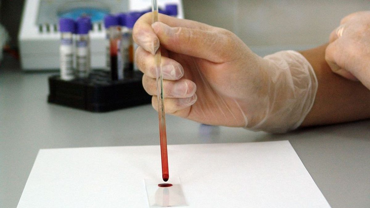 Tratan un nuevo análisis de sangre en desarrollo que puede detectar hasta 20 tipos de cáncer