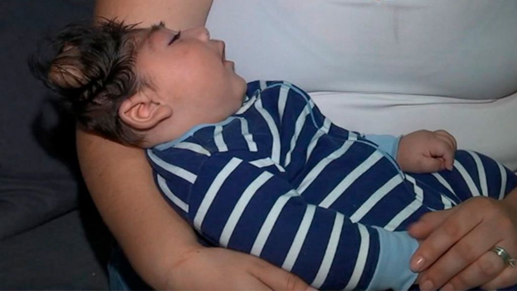 Lucas es el primer bebé del mundo que sobrevive tras nacer con medio cerebro fuera Lucas es el primer bebé del mundo que sobrevive tras nacer con medio cerebro fuera