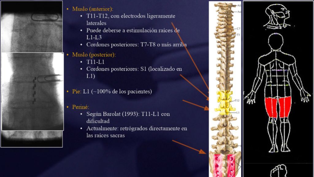 estimulacion