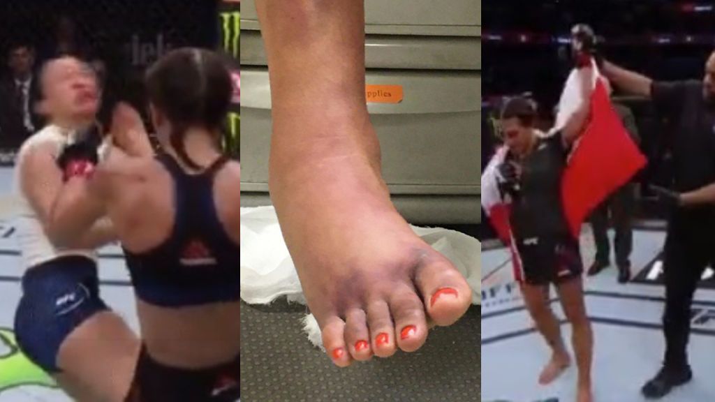 Una luchadora de la UFC se rompe el pie durante el combate pero