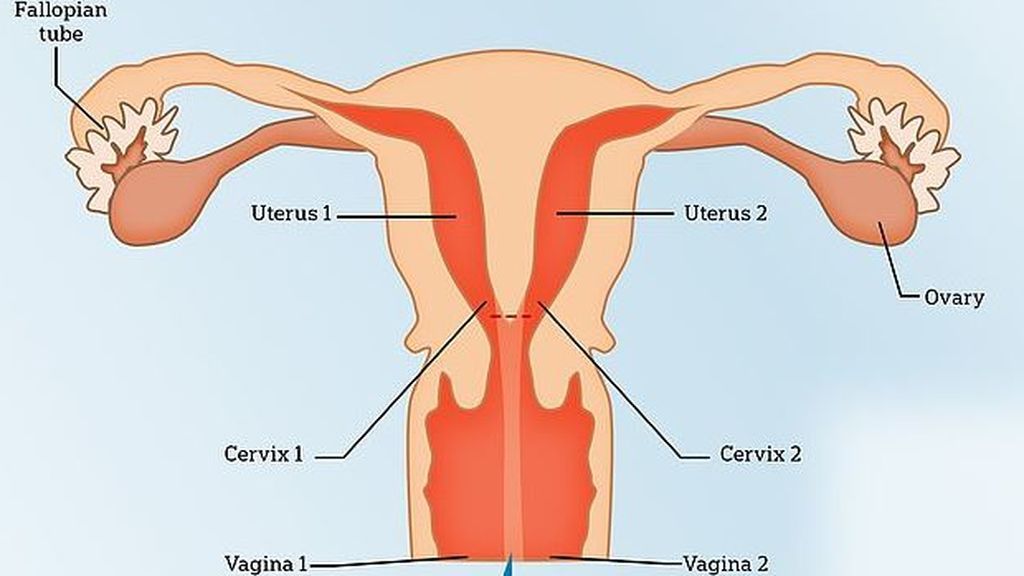 Mujer con 2 vaginas