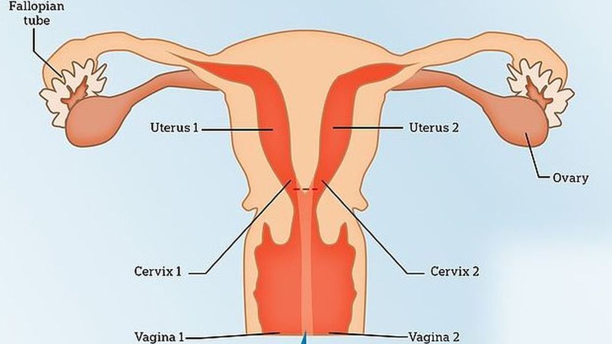 Una joven descubre que tiene dos vaginas tras años de terribles dolores menstruales