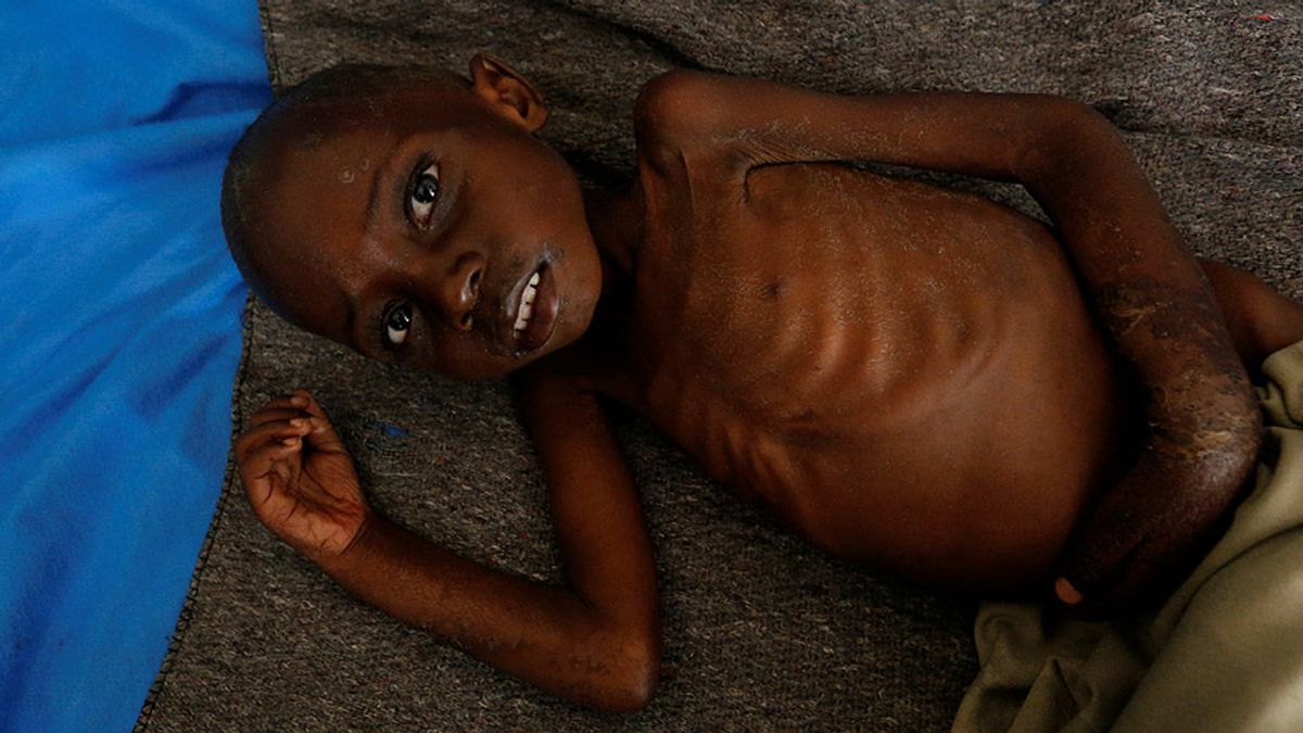 UNICEF alerta de que uno de cada tres niños en el mundo está desnutrido u obeso UNICEF alerta de que uno de cada tres niños en el mundo está desnutrido u obeso