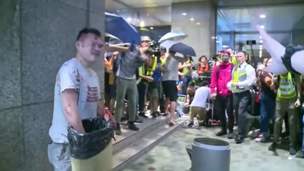 Un hombre hiere con un cuchillo a 4 personas y arranca media oreja de un mordisco a un concejal en Hong Kong
