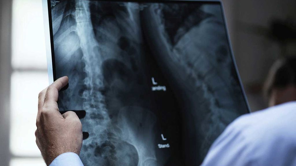 Condenan a la sanidad andaluza por recetar relajante muscular a una paciente que murió de cáncer que murió Condenan a la sanidad andaluza por recetar relajante muscular a una paciente que murió de cáncer que murió