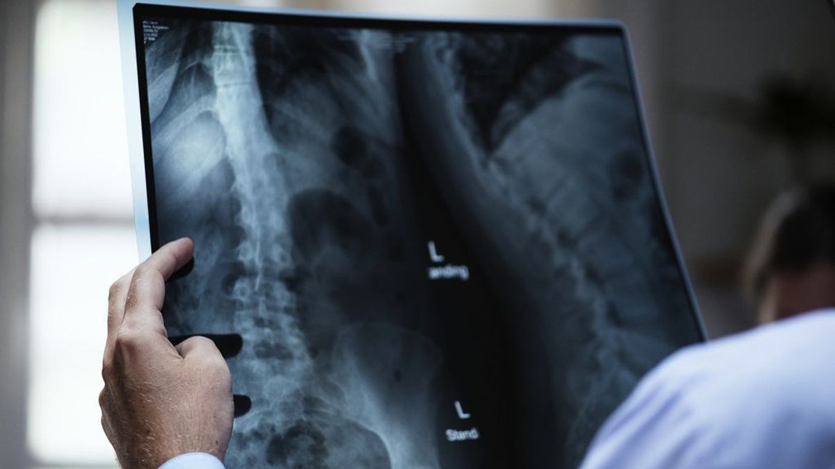 La antigüedad de los equipos de radiología es un problema grave en España