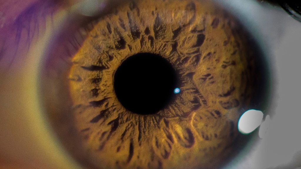 La diabetes ocular: el riesgo de una enfermedad asintomática La diabetes ocular: el riesgo de una enfermedad asintomática