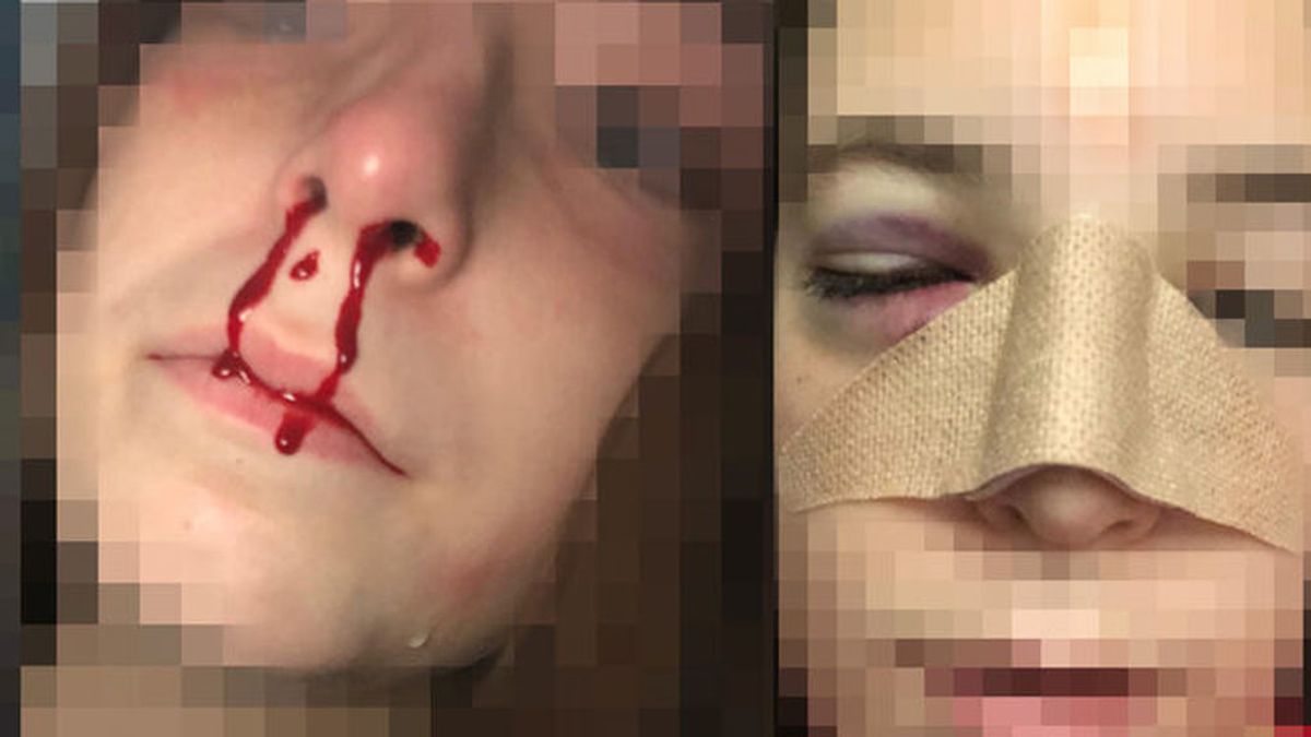 Una menor es agredida brutalmente por otro alumno en un instituto en Jerez