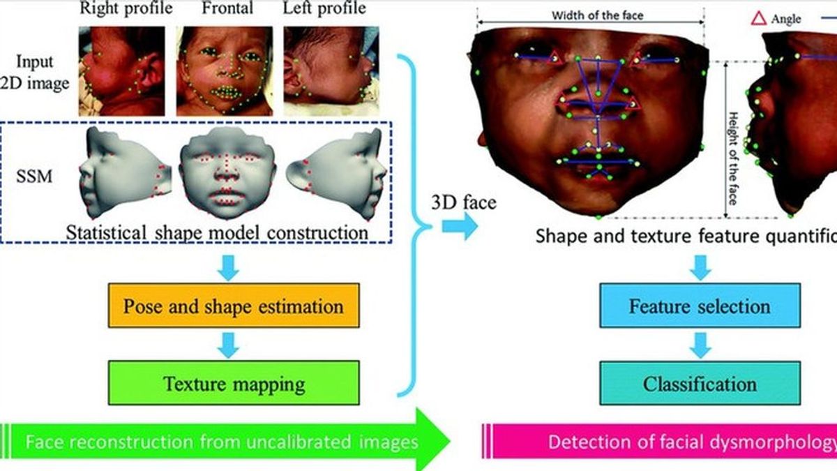 Científicos españoles y de EEUU crean un método de análisis facial que detecta síndromes genéticos en niños Científicos españoles y de EEUU crean un método de análisis facial que detecta síndromes genéticos en niños