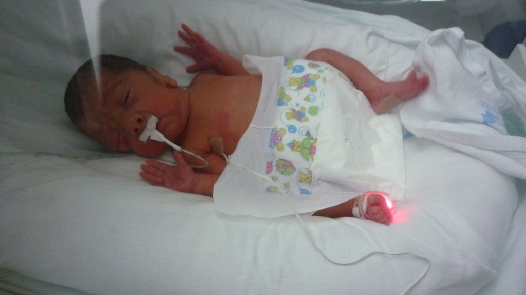 La lucha de los bebés prematuros