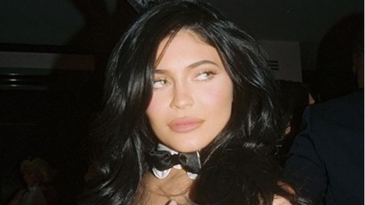 Su obesión por parecerse a Kylie Jenner acaba mal: termina con la boca llena de pus por operarse los labios