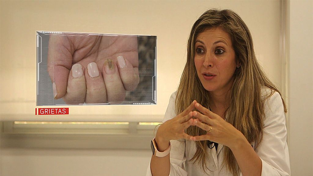 Una dermatóloga nos habla del riesgo de los esmaltes permanentes