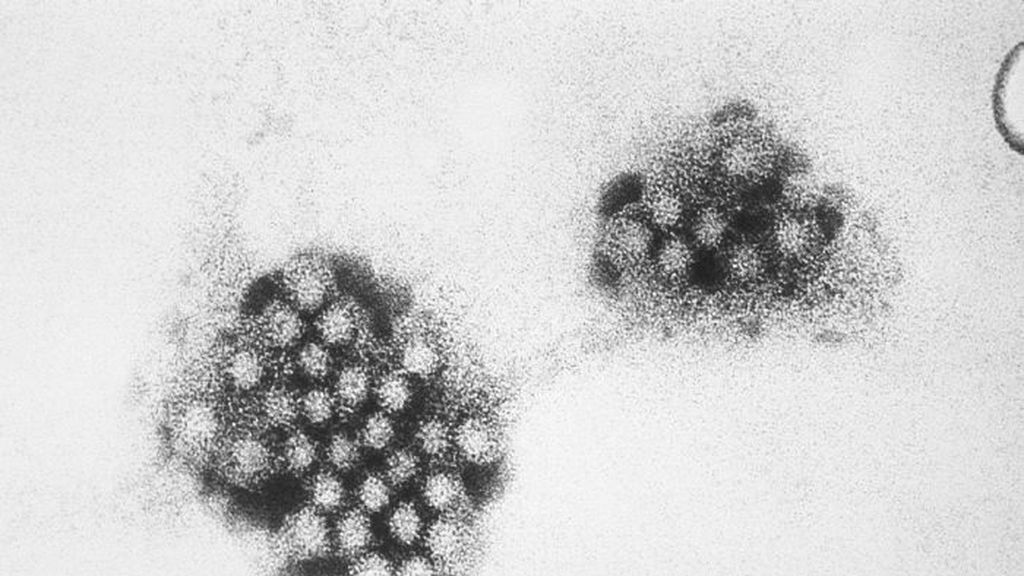 Alerta por el norovirus en Inglaterra: 60 escuelas se han visto afectadas y varias han cerrado sus aulas