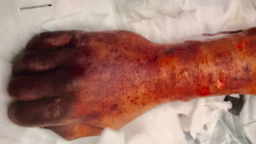 l European Journal of Case Reports in Internal Medicine .