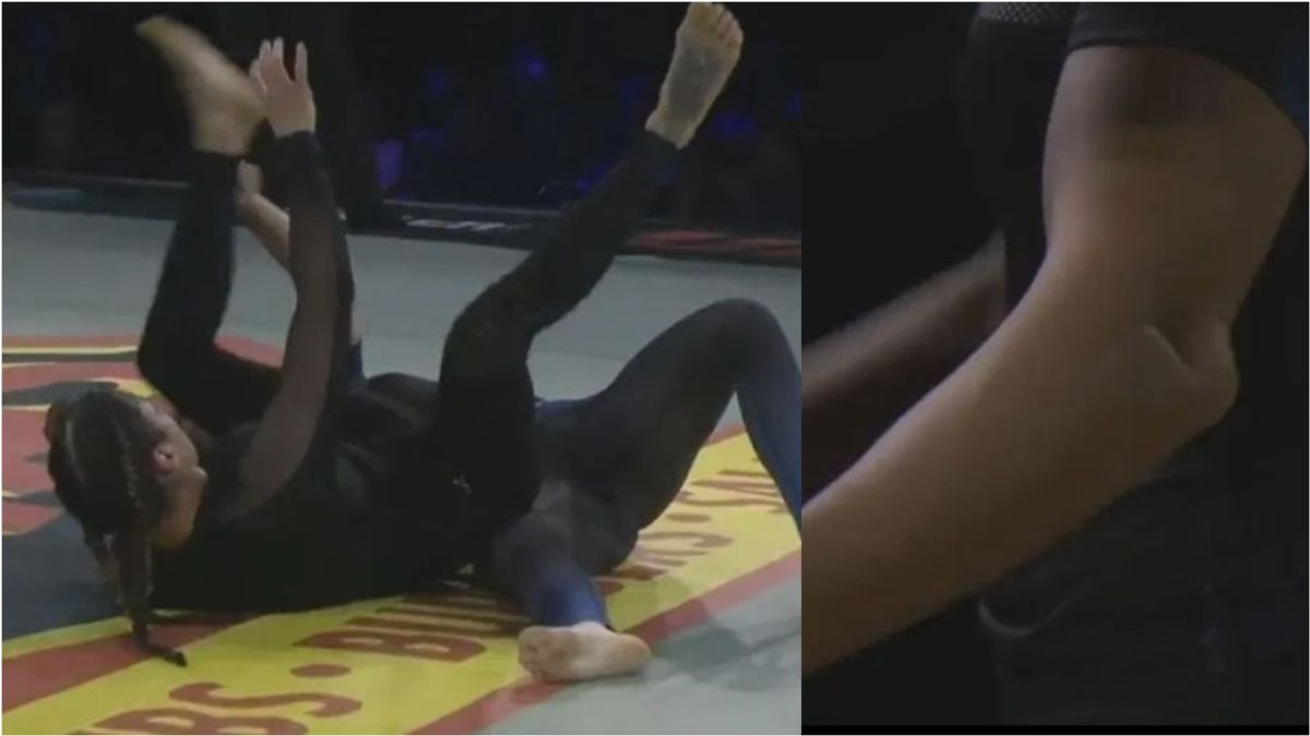 Una exluchadora de la UFC le parte el brazo a su oponente durante un combate de Jiu-Jitsu Una exluchadora de la UFC le parte el brazo a su oponente durante un combate de Jiu-Jitsu