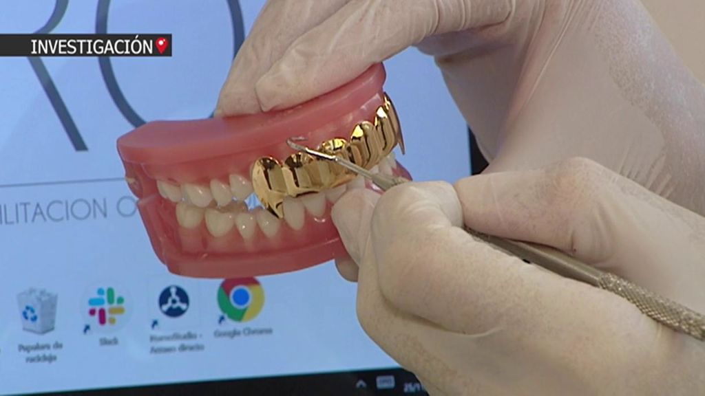 Los riesgos de ponerse dientes de oro