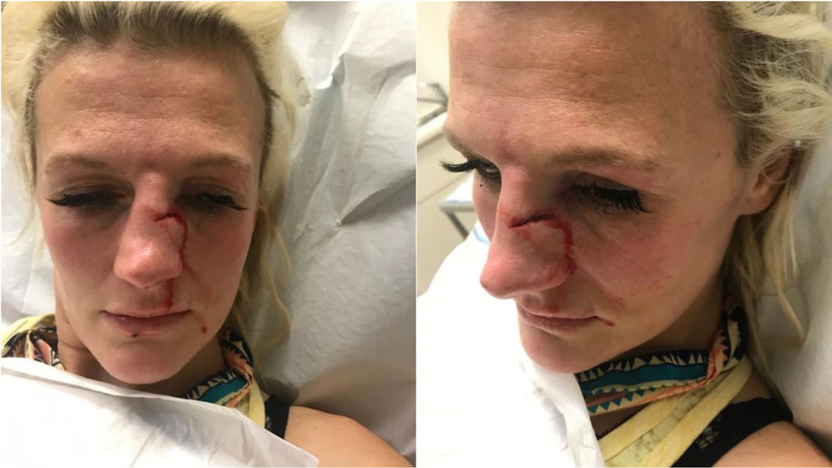 Una luchadora de MMA, víctima de violencia de género: su exnovio la espera fuera de su casa para agredirla con un juego de llaves