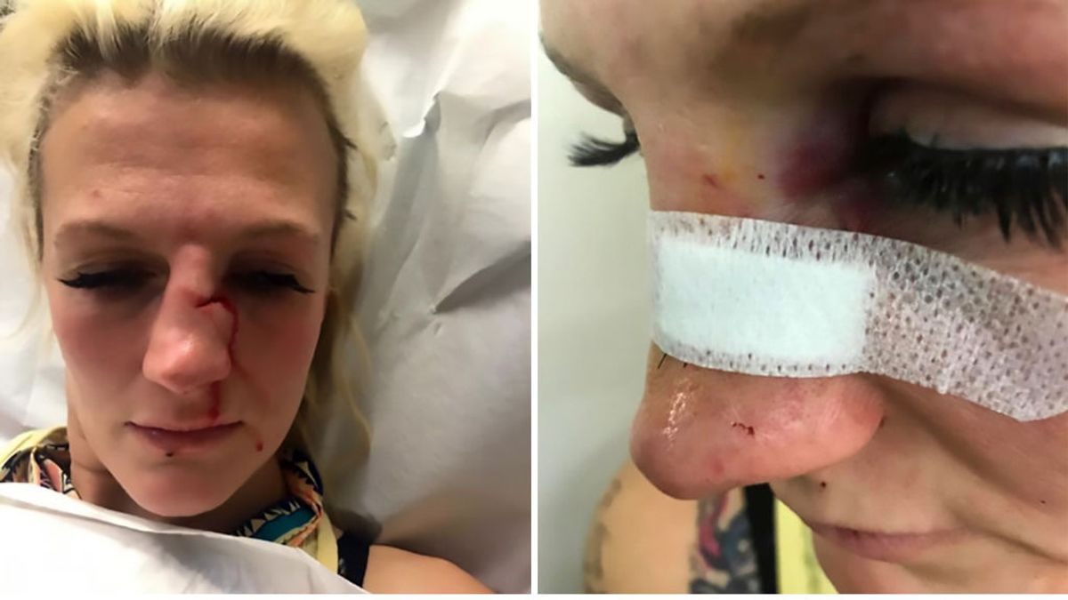 La estrella de las MMA, Cindy Dandois, recibe una paliza de su exnovio tras cortar la relación con él La estrella de las MMA, Cindy Dandois, recibe una paliza de su exnovio tras cortar la relación con él