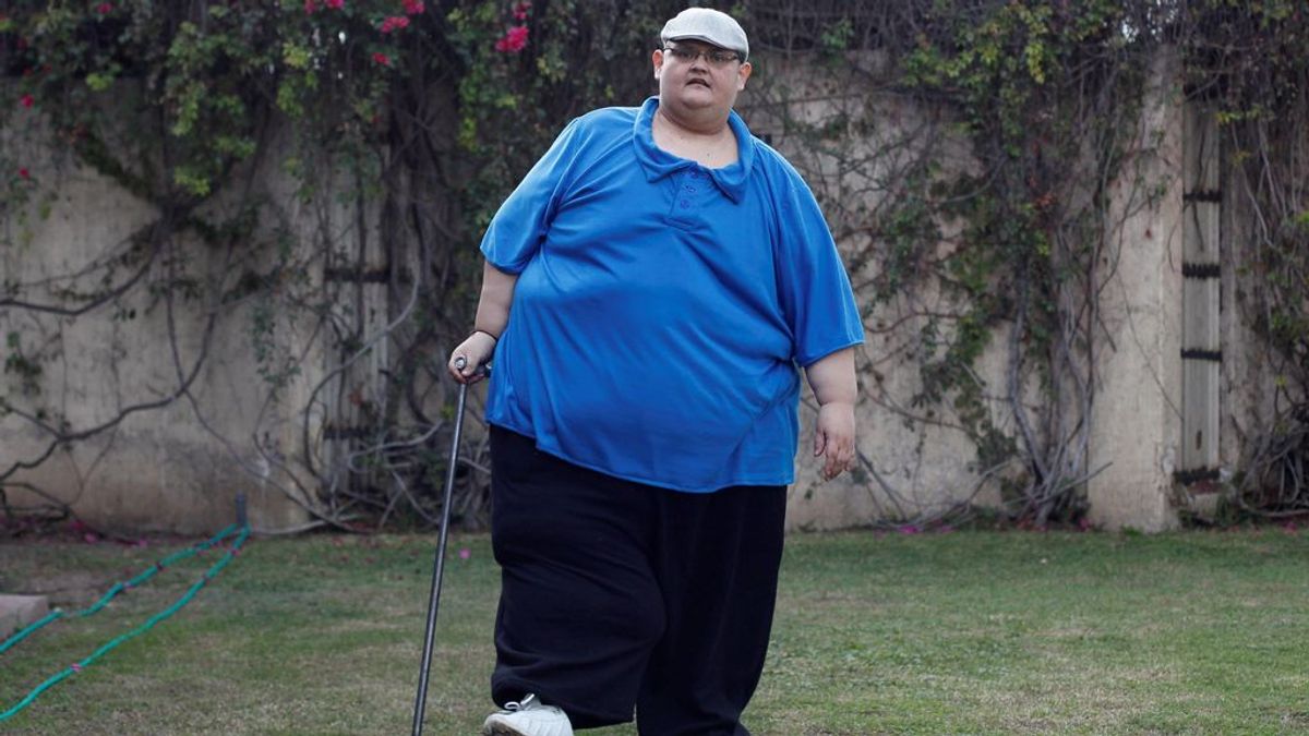 El hombre más gordo del mundo, Juan Pedro Franco, pierde 334 kilos