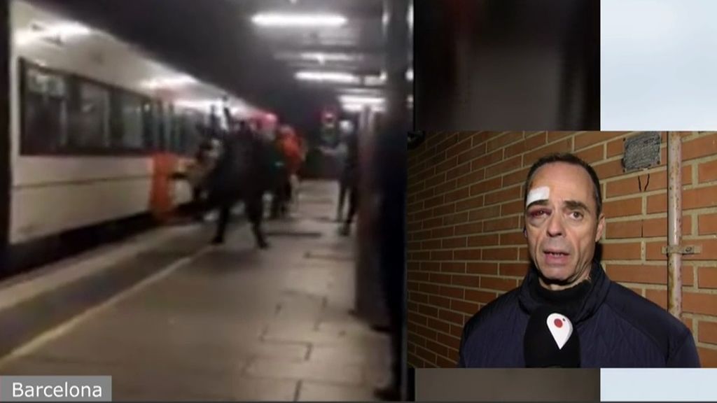 El vigilante que casi pierde el ojo en el metro de Barcelona