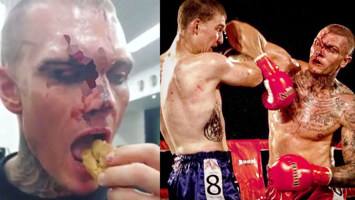 Los codazos en la cara dejan a un luchador de Muay Thai completamente destrozado