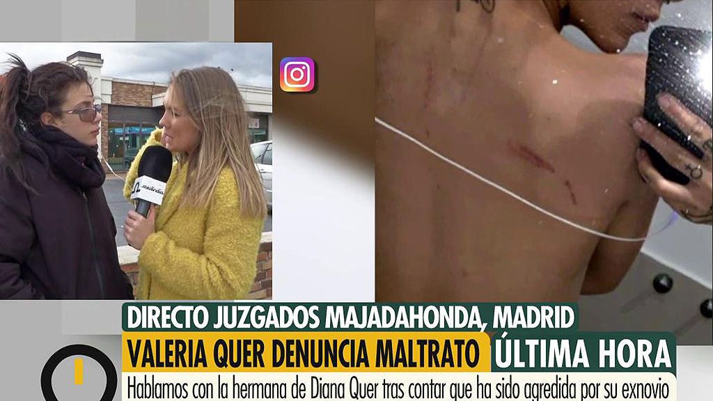 Valeria Quer ha decidido no denunciar a su exnovio por maltrato: "No es una paliza, son daños de diferentes días"