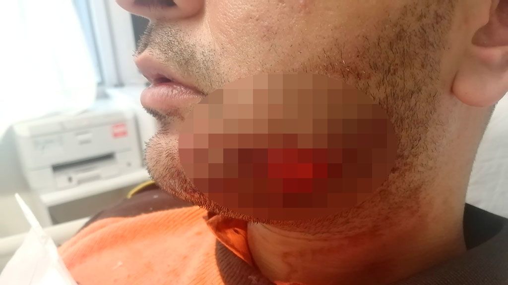 Atacan a mordiscos a un vigilante de seguridad en el Metro de Barcelona Atacan a mordiscos a un vigilante de seguridad en el Metro de Barcelona