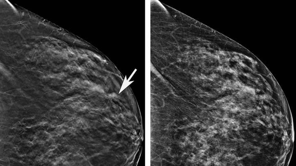 Nanopartículas ‘inteligentes’ con GPS: así es la nueva patente contra el cáncer de mama de la Universidad de Granada Nanopartículas ‘inteligentes’ con GPS: así es la nueva patente contra el cáncer de mama de la Universidad de Granada