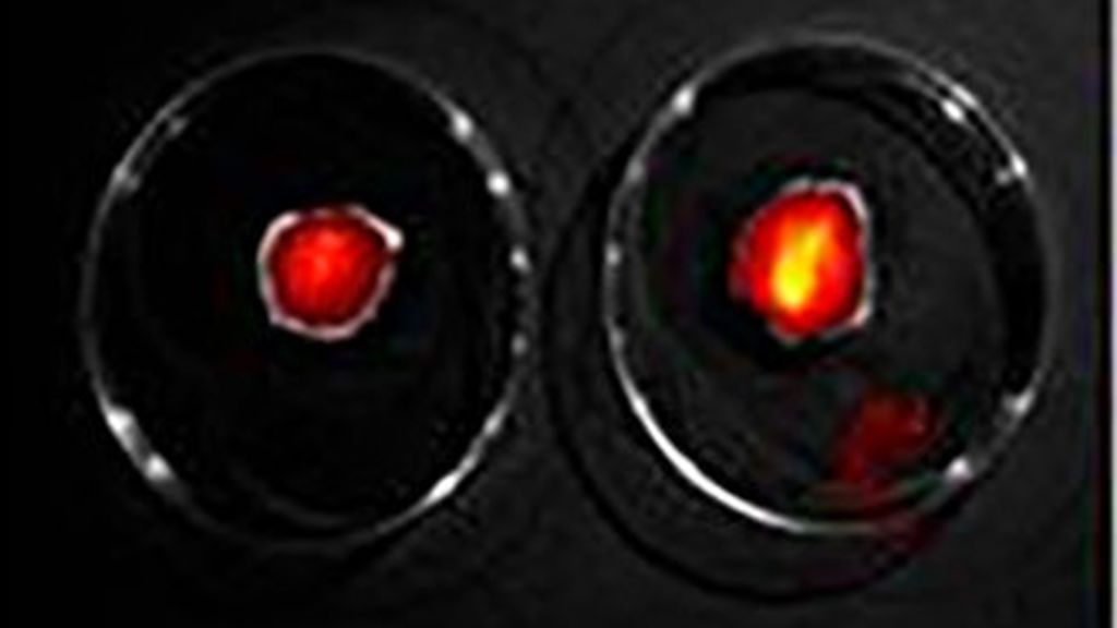 nanoparticulas