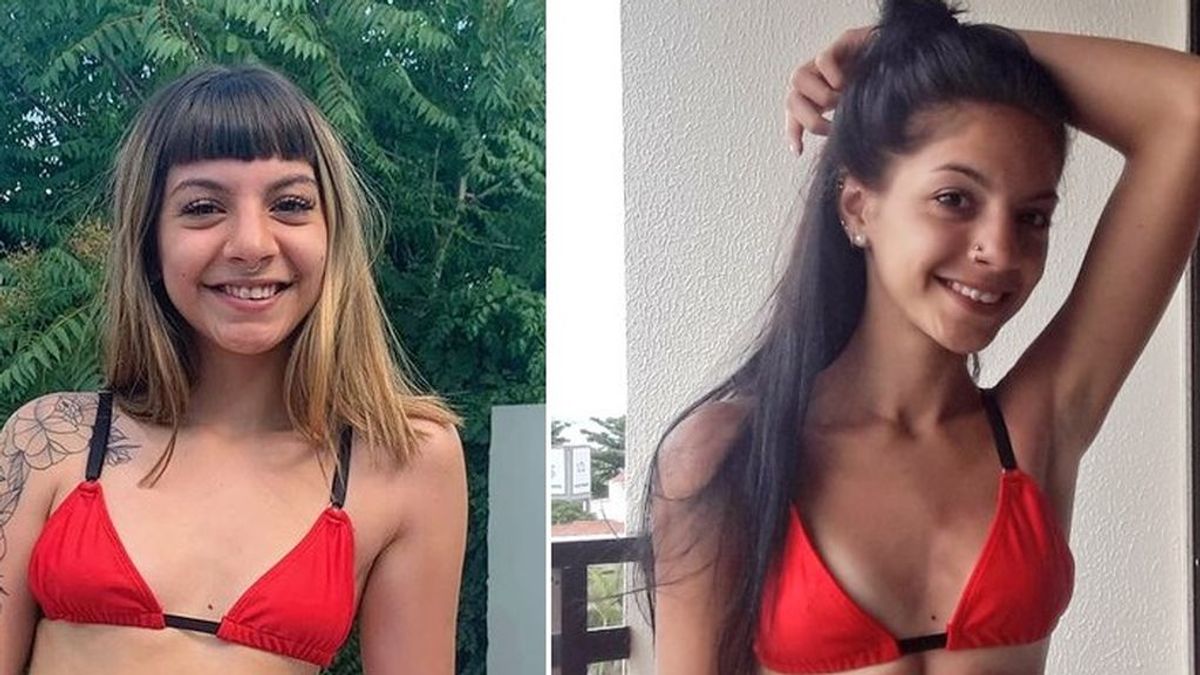 Una joven, de 18 años, con anorexia se hace viral contando su recuperación