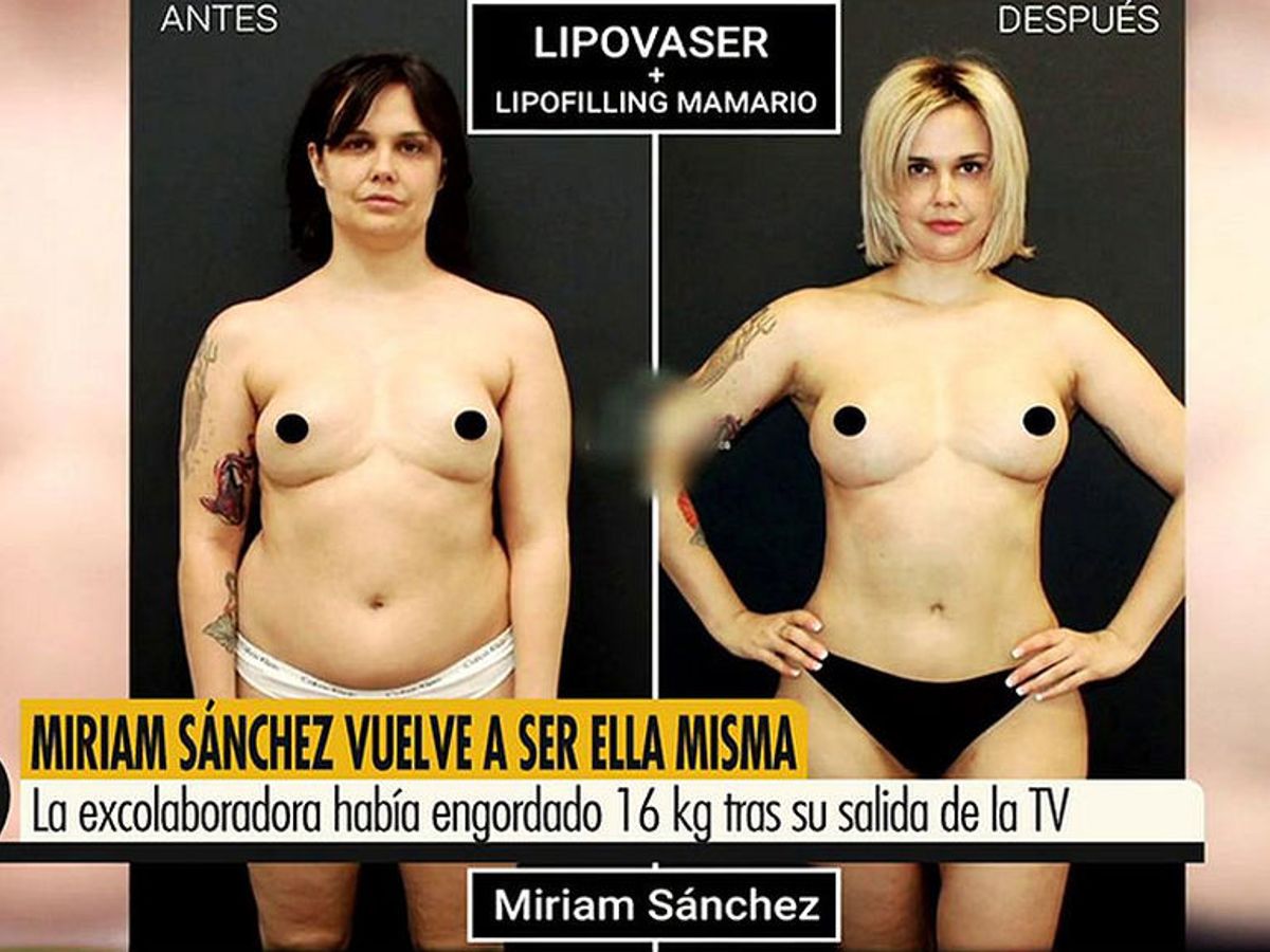 Miriam Sánchez, feliz con su nuevo físico: “Pues bien mona que estoy”