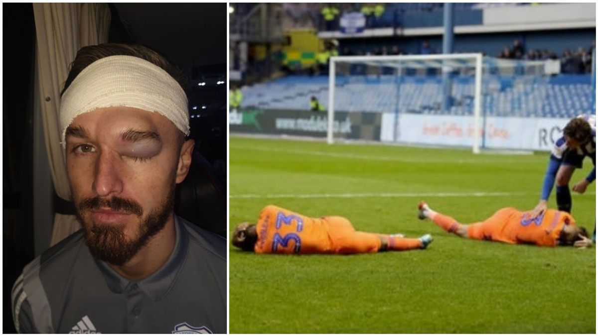 La cara desfigurada de un jugador del Cardiff tras chocarse con un compañero: "Tienes la cabeza de cemento"