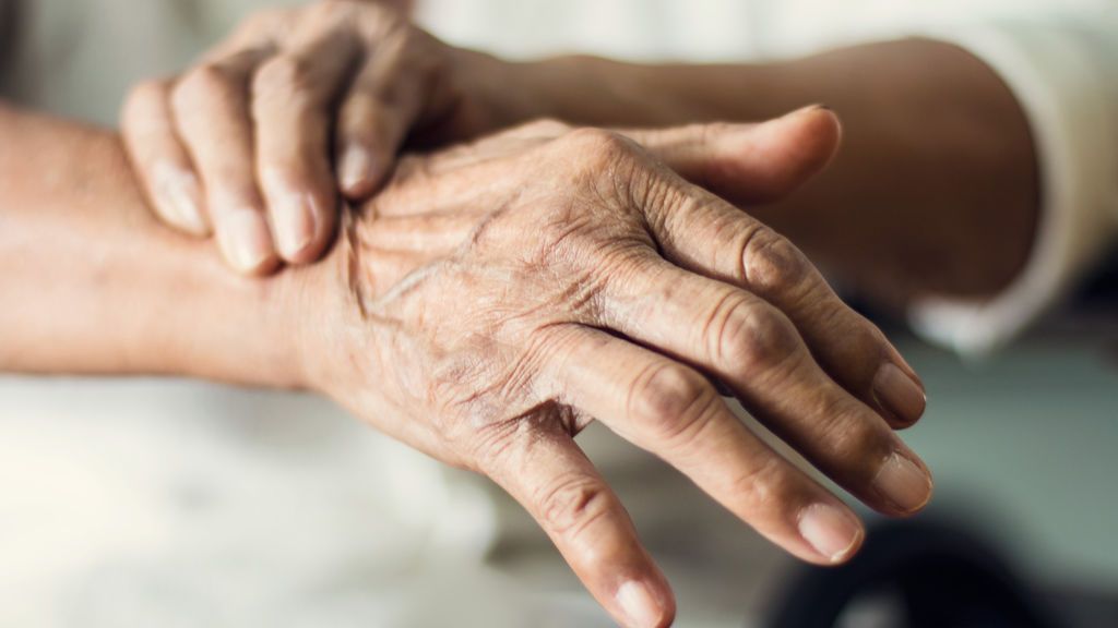 Exclusiva Uppers: las 20 medidas del Plan Nacional del Alzheimer que maneja el Gobierno