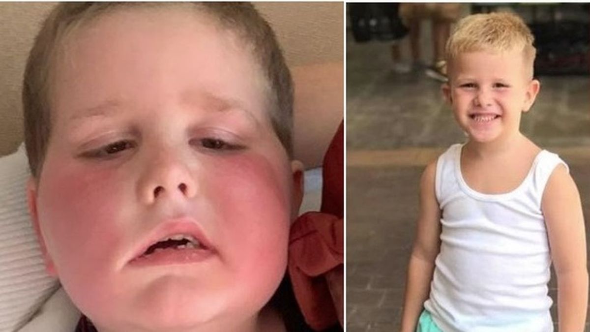 Muere un niño de 7 años que luchaba contra un tumor cerebral