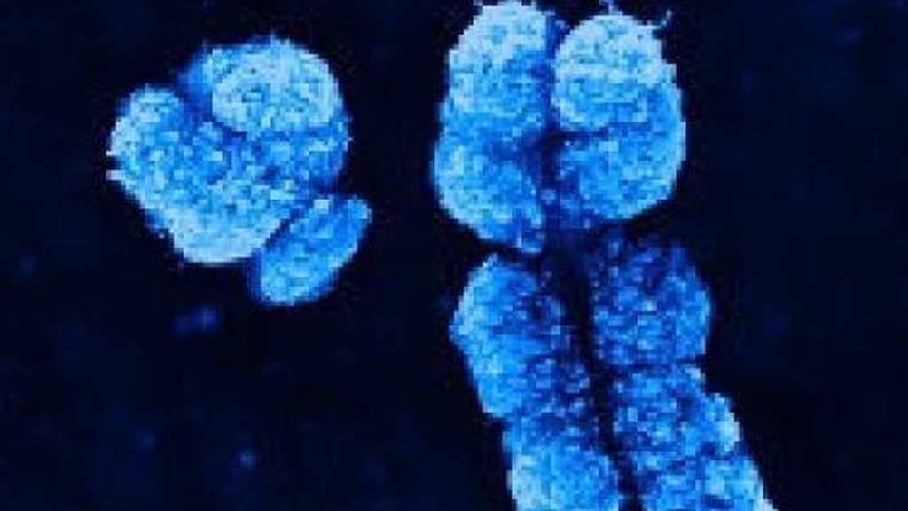 Por qué los hombre tienen más riesgo de padecer cáncer que las mujeres Por qué los hombre tienen más riesgo de padecer cáncer que las mujeres