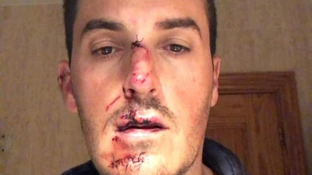 Se busca un coche blanco con un retrovisor roto que se dio a la fuga tras atropellar a un ciclista Se busca un coche blanco con un retrovisor roto que se dio a la fuga tras atropellar a un ciclista