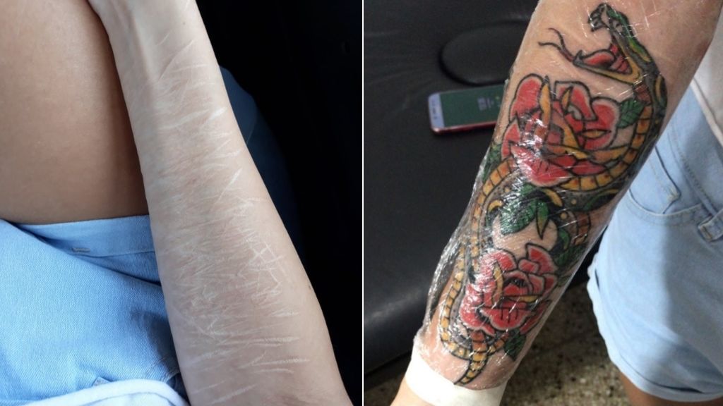 Una chica tapa las cicatrices de sus autolesiones con un tatuaje muy inspirador