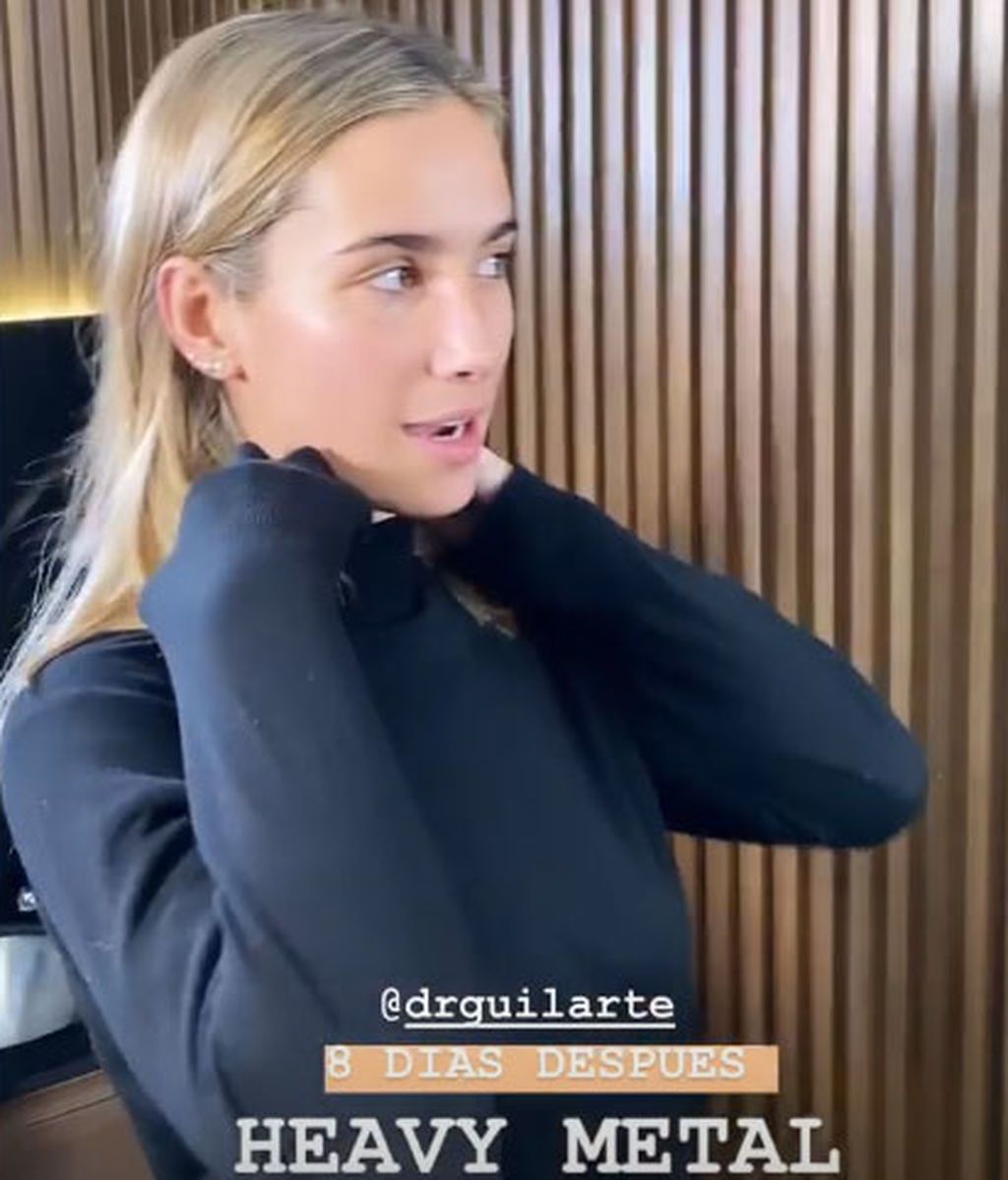 María Pombo, tras su rinoplastia