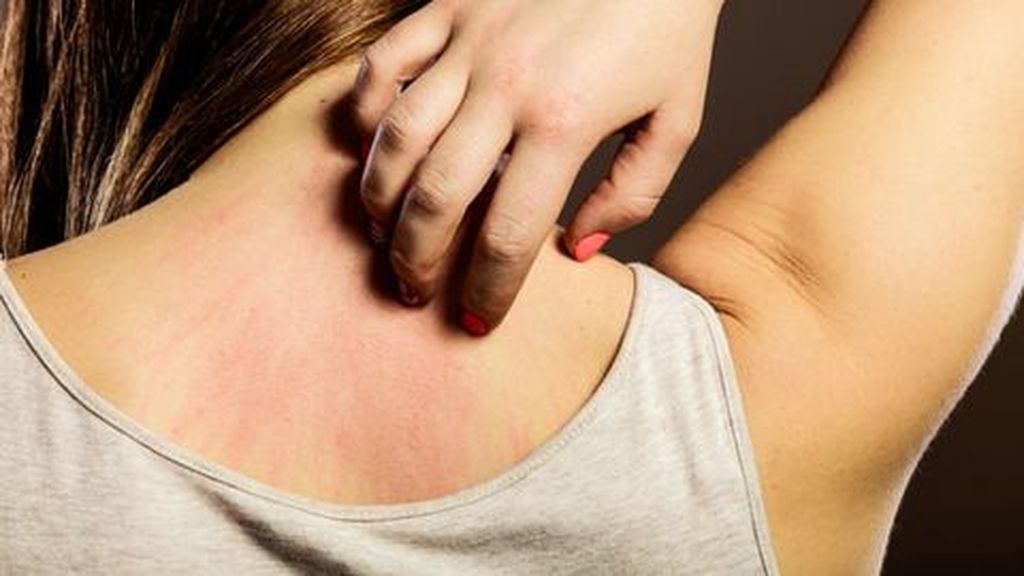 Rascarse de manera compulsiva puede provocar un trastorno psicológico y físico Rascarse de manera compulsiva puede provocar un trastorno psicológico y físico