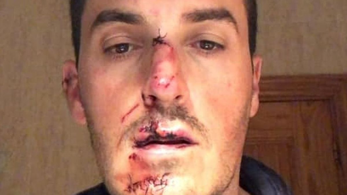 La Guardia Civil localiza al conductor que atropelló a un ciclista en Granada y se dio a la fuga La Guardia Civil localiza al conductor que atropelló a un ciclista en Granada y se dio a la fuga