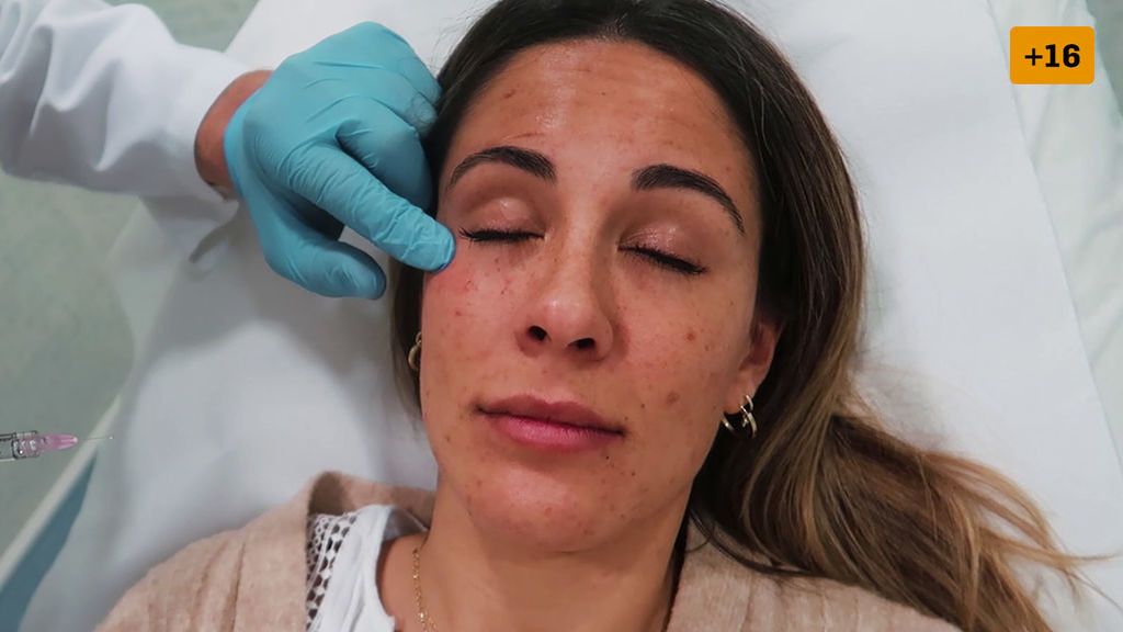 Susana no nota mejoría en su tratamiento de ojeras y se desespera (1/2)