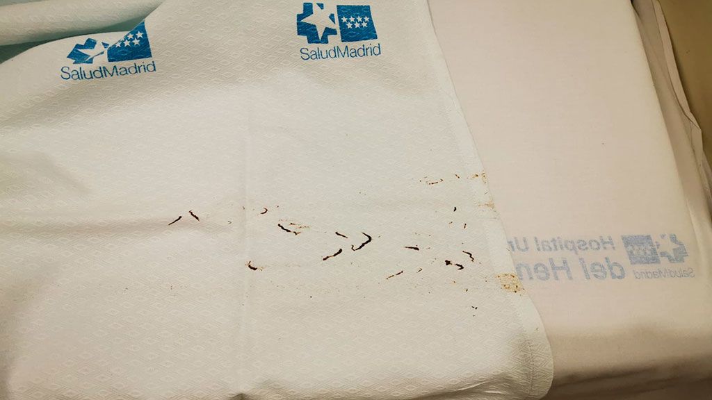Ropa sucia en los hospitales madrileños: "los pacientes se pueden pasar días sin almohadas" Ropa sucia en los hospitales madrileños: "los pacientes se pueden pasar días sin almohadas"