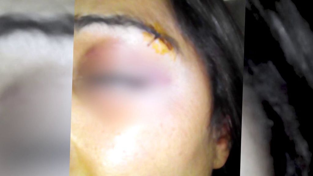 'La Americana': así es la vecina que tiene atemorizada a un barrio de Vigo por sus agresiones