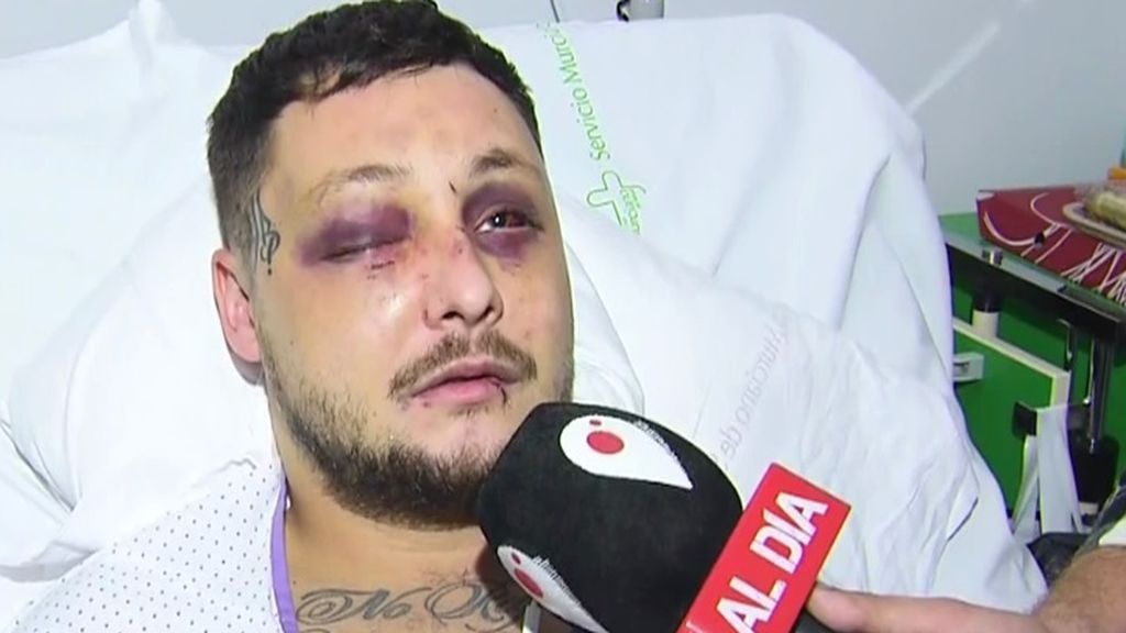 Raúl, el hombre que defendió a una mujer y recibió una paliza en Murcia