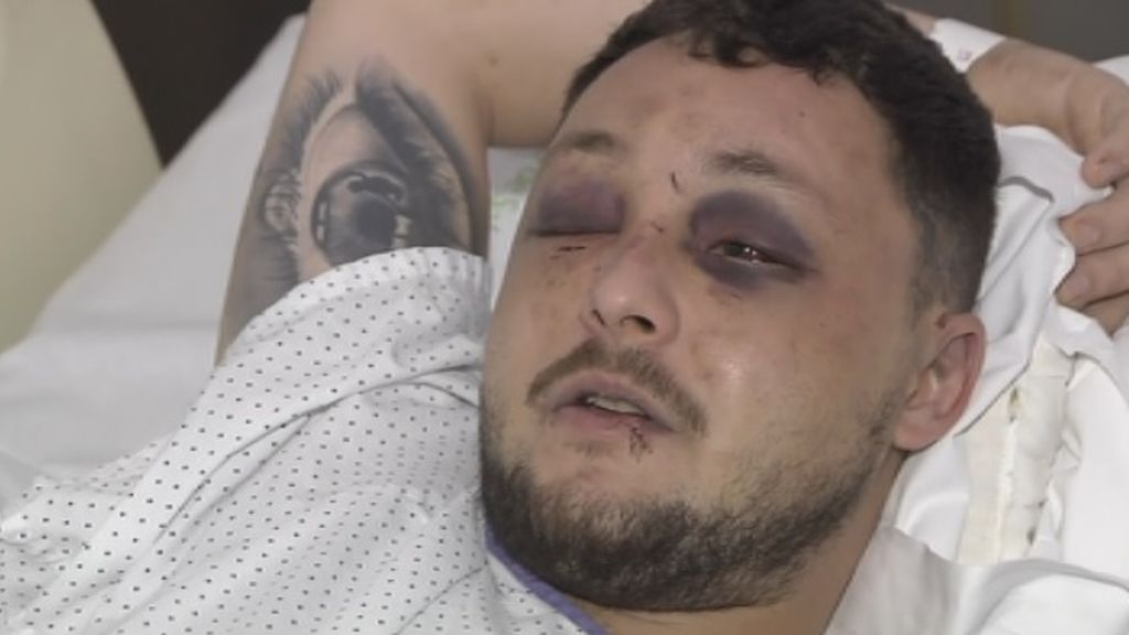 Raúl, el héroe que defendió a una mujer golpeada por su pareja en Murcia y terminó en el hospital