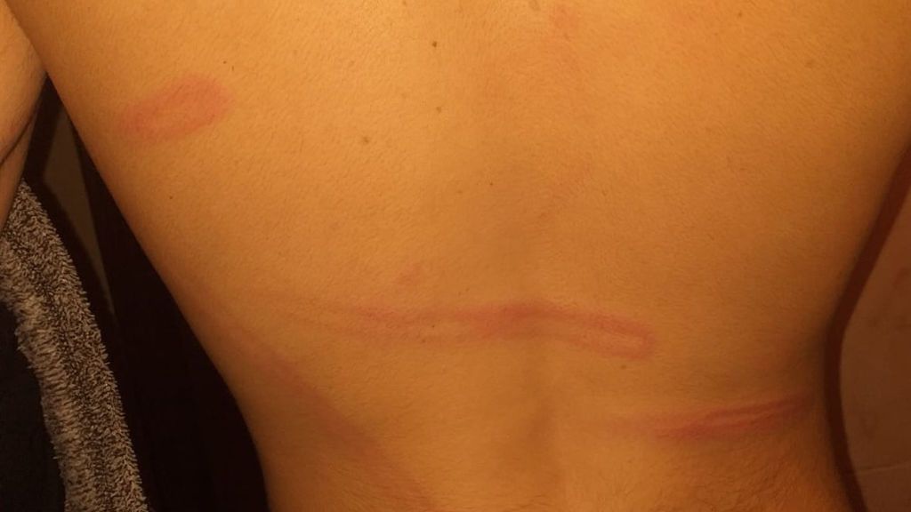 joven agredido