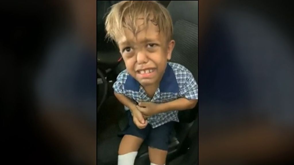 Quaden, el niño australiano que sufre bullying y que conmueve a la Red