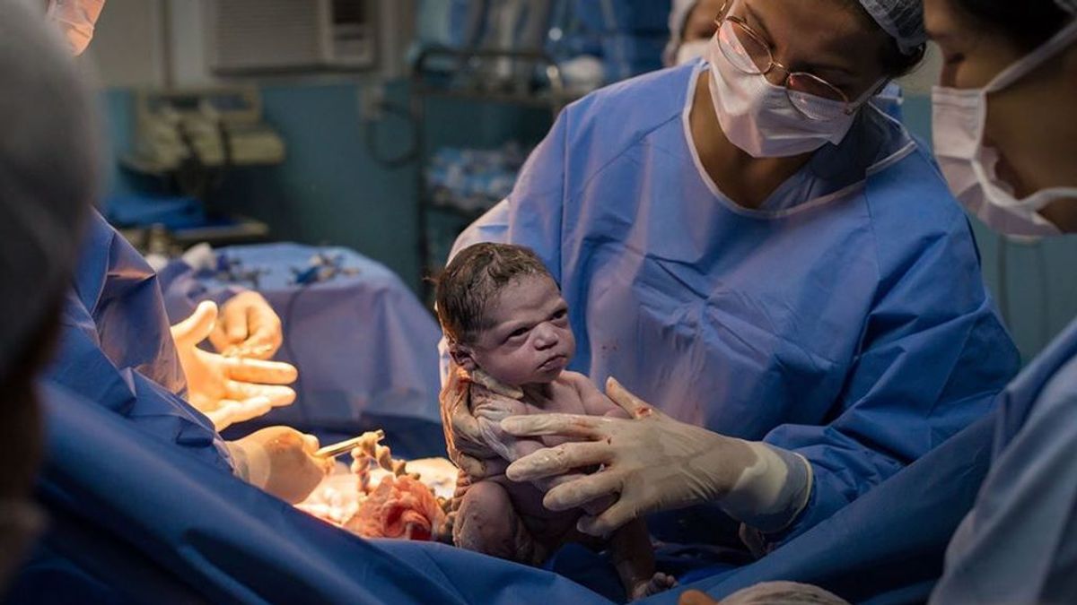 Isabela, la bebé que nace 'enfadada' y sin llorar: su foto se ha hecho viral