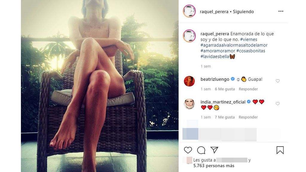 Raquel Perera comparte este sensual posado y le preguntan si tiene vitíligo